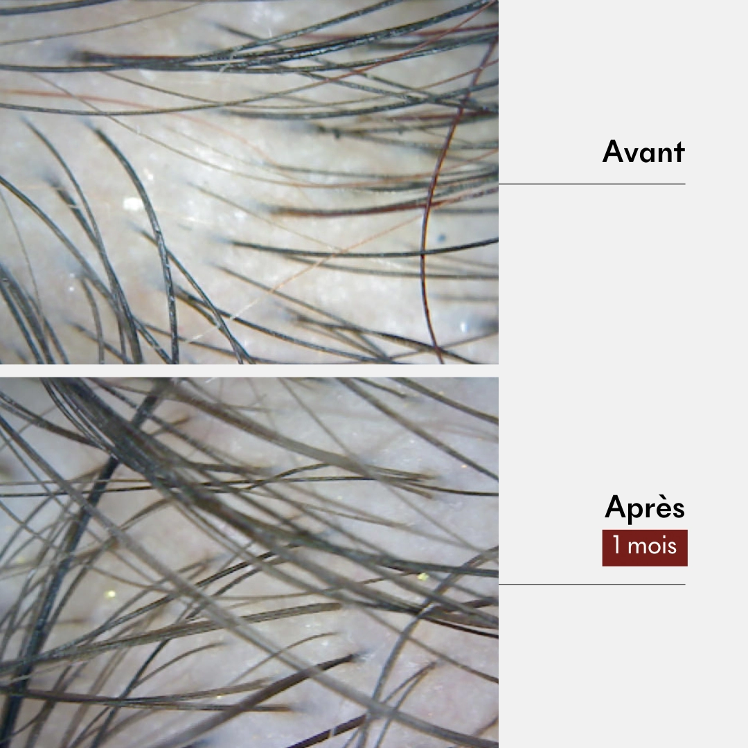 produit: Gommage Actif Anti-chute & Pousse - Tricho-force