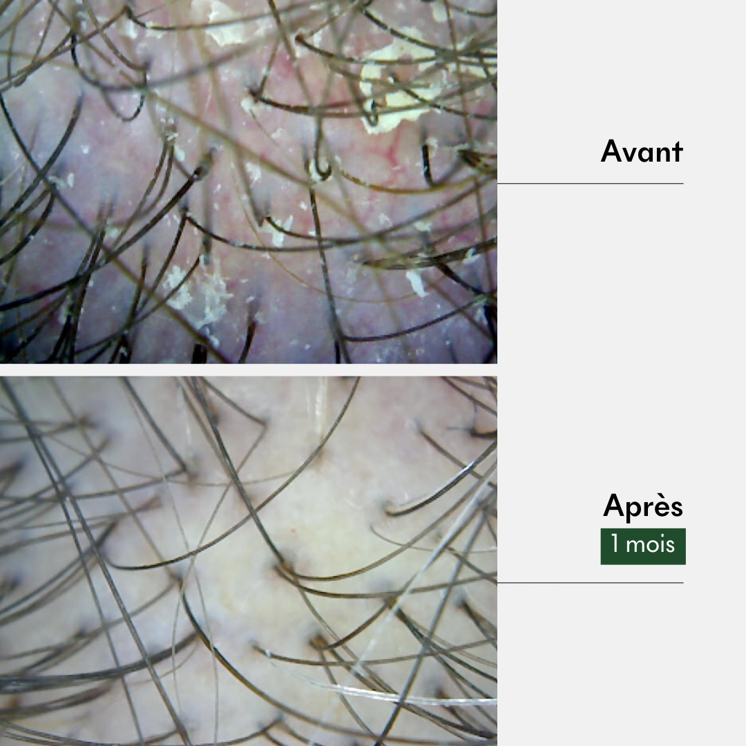 produit: Gommage Actif Anti-pelliculaire - Tricho-pure