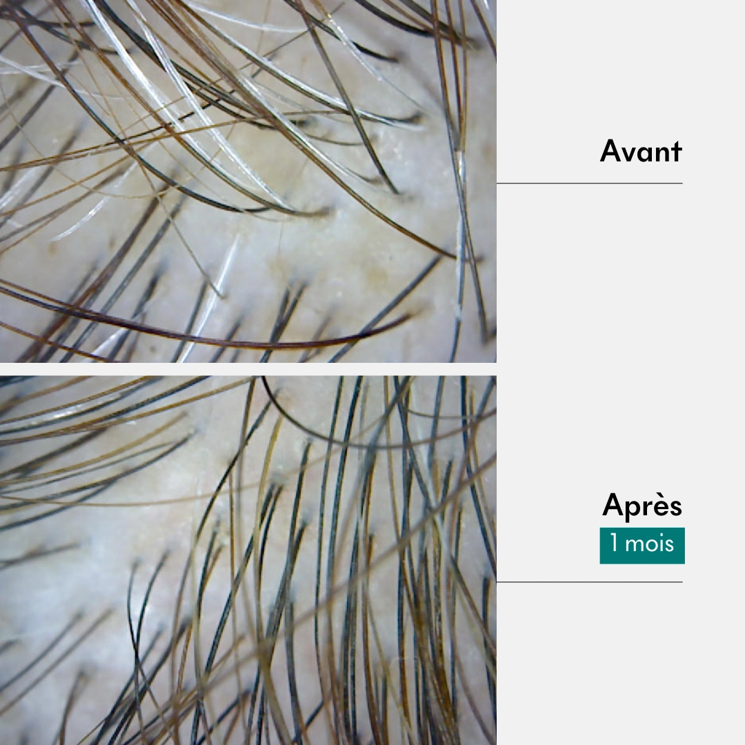 produit: Gommage Actif Anti-âge - 1ers Cheveux Blancs- Boue Tricho-mela+