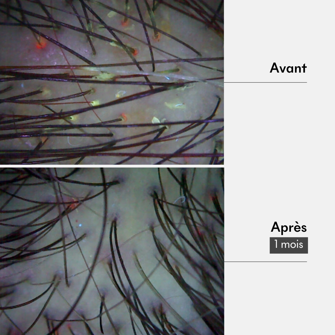 produit: Gommage Actif Détox - Cheveux Gras - Tricho-detox