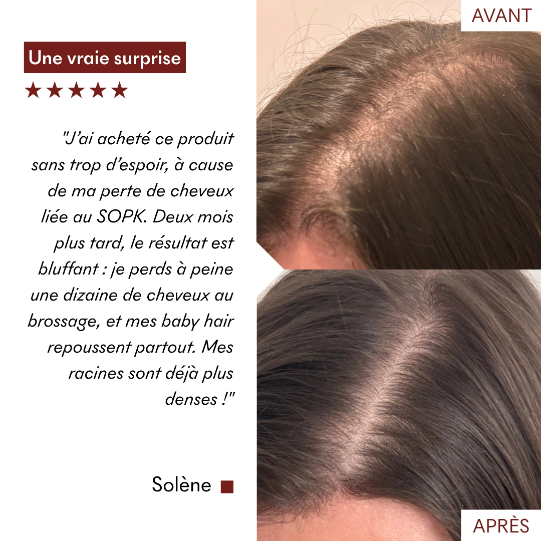 produit: Serum Croissance Tricho-boost