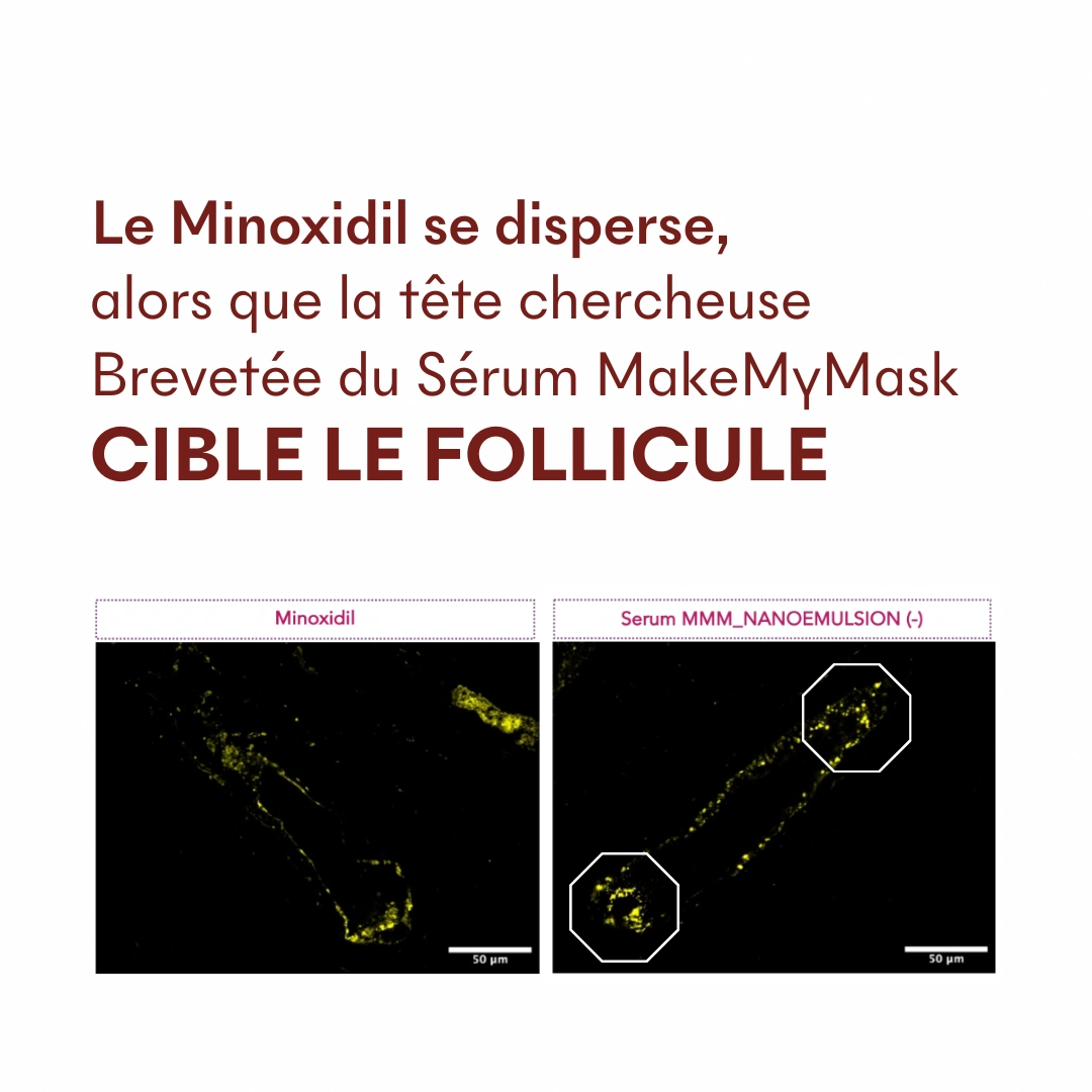 produit: Serum Croissance Tricho-boost