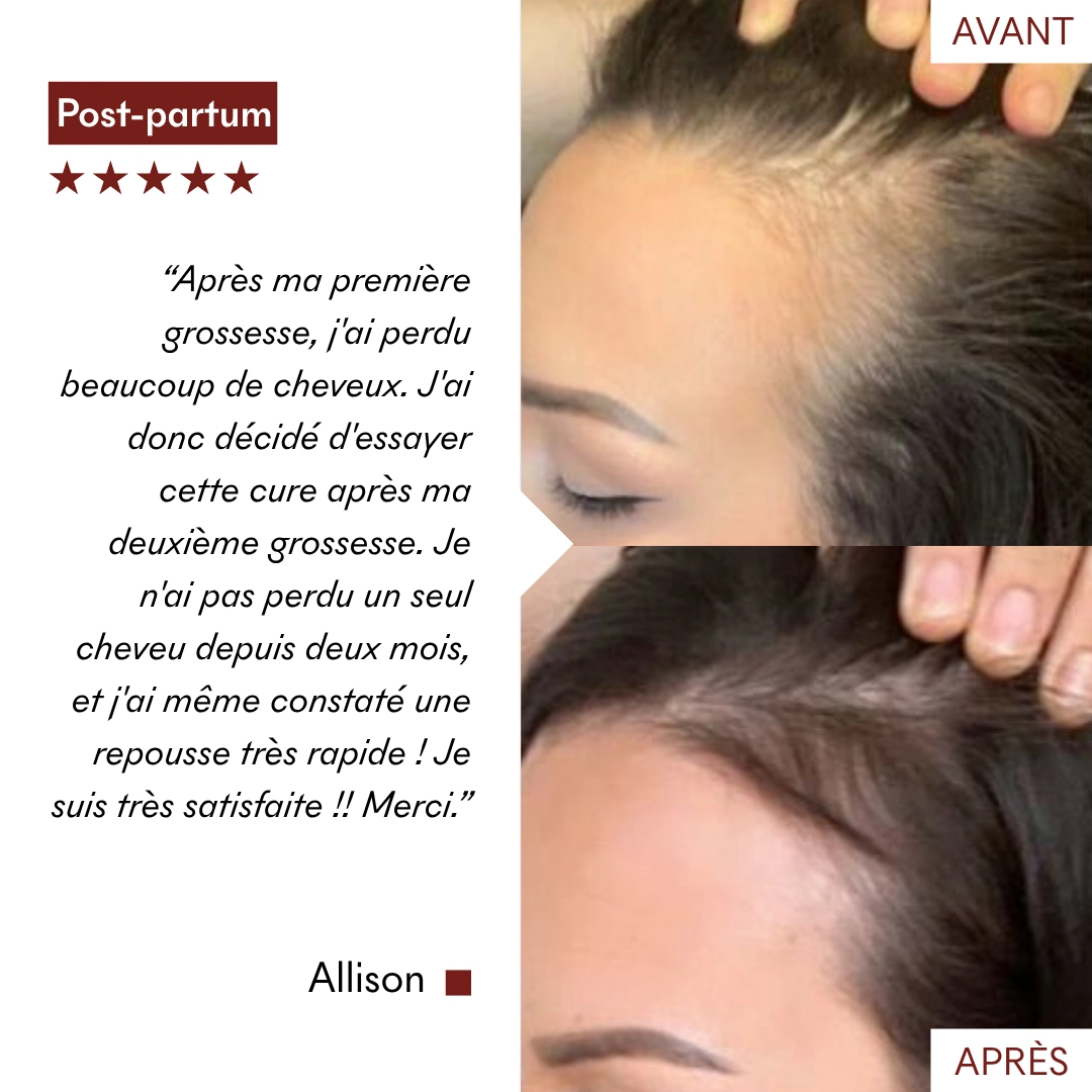 produit: Serum Croissance Tricho-boost