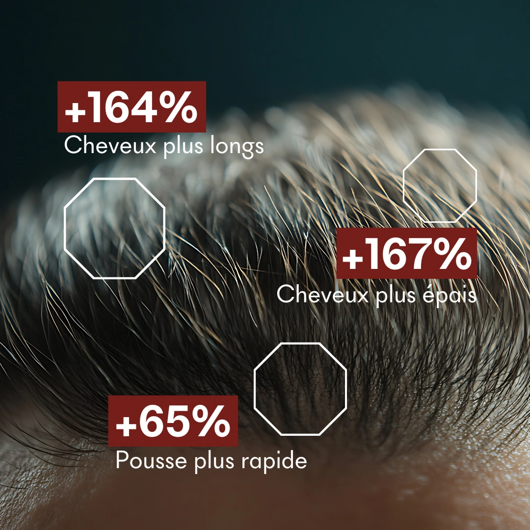 produit: Serum Croissance Tricho-boost