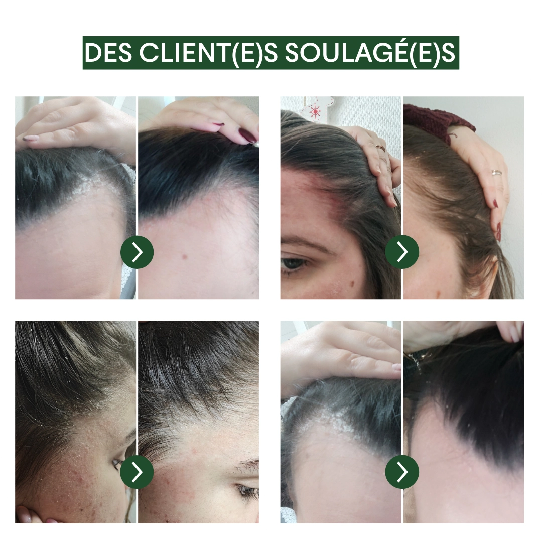 produit: Crème Exfoliante - Tricho-pure