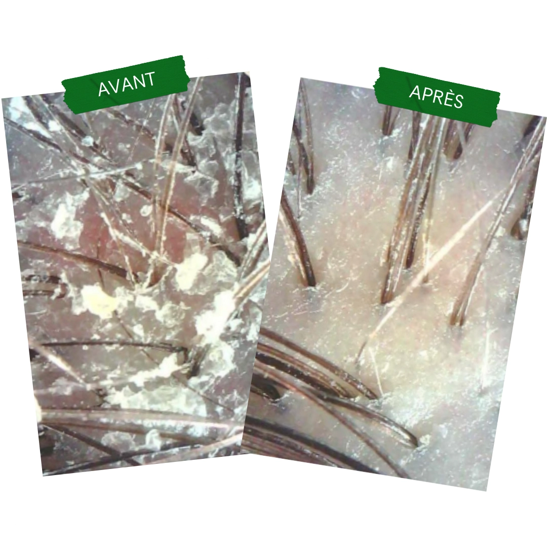 produit: Crème Exfoliante - Tricho-pure